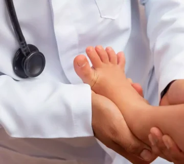 العلاج الطبيعي للاطفال